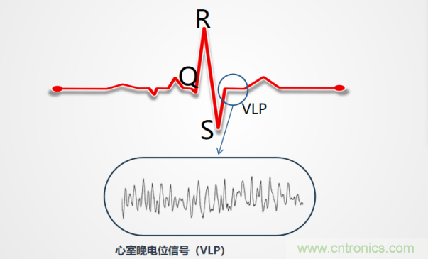 解決心電監(jiān)測(cè)行業(yè)難題，曼森伯格的濾波技術(shù)獲國(guó)家知識(shí)產(chǎn)權(quán)局發(fā)明授權(quán)