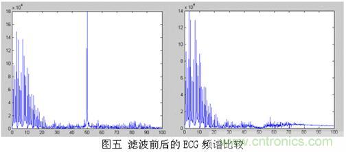采用MSP430設計的12位心電(ECG)放大器 采用MSP430設計的12位心電(ECG)放大器